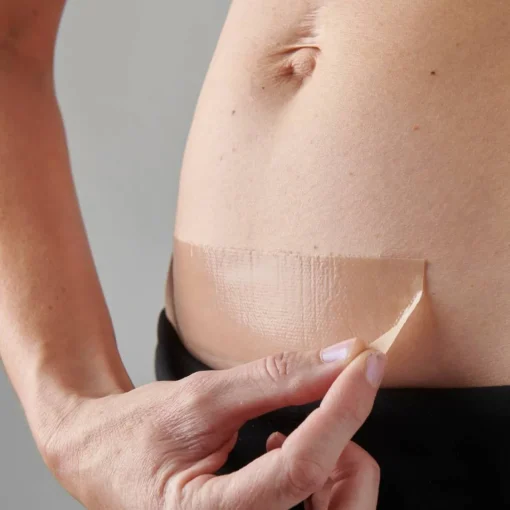 Self-Care|Recovery*Myscar The Active Caesarean Silicone Strips