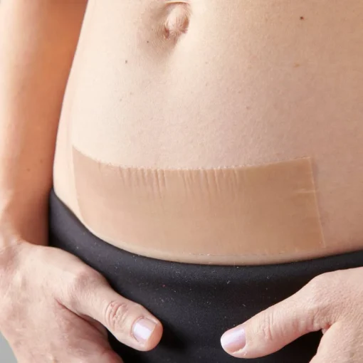 Self-Care|Recovery*Myscar The Original Caesarean Silicone Strips