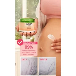 Self-Care|Recovery*Weleda Stretch Mark Body Butter